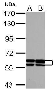 GDF-5/BMP-14 Antibody - BSA Free