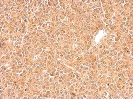 GGPS1 Antibody