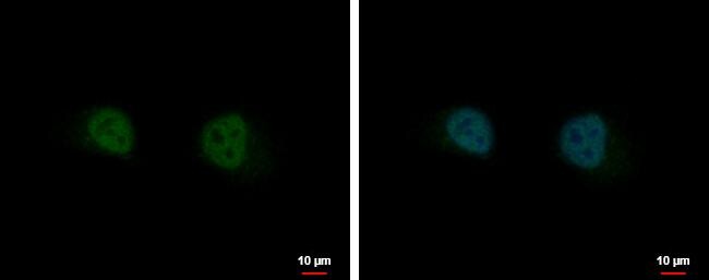 GIT2 Antibody - BSA Free