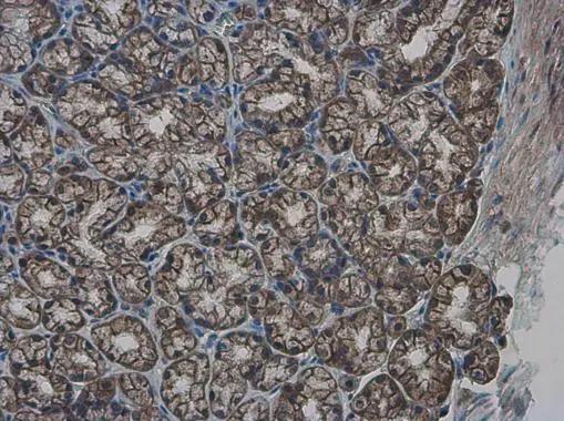 GLMN Antibody