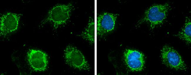 Glutamate Dehydrogenase Antibody