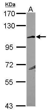KA1/GRIK4/Glutamate Receptor KA1 Antibody - BSA Free