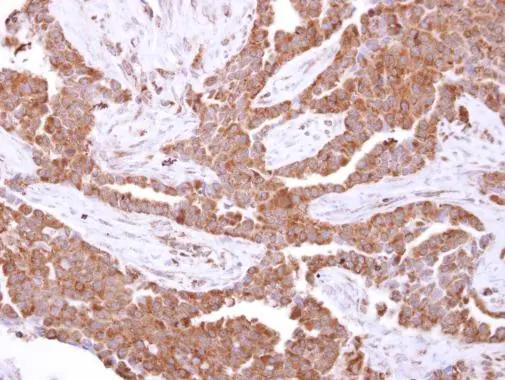 Glutathione S Transferase kappa 1 Antibody - BSA Free