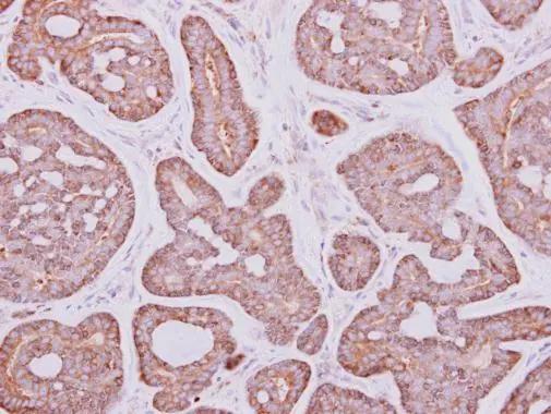 Glycogen phosphorylase, muscle form Antibody - BSA Free