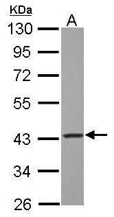 GOT2 Antibody
