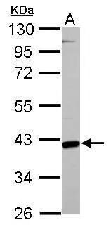 GOT2 Antibody