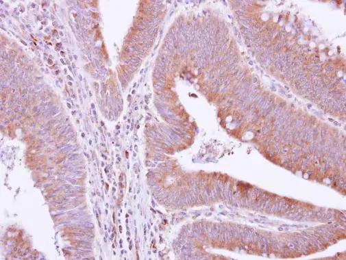 GRAP Antibody