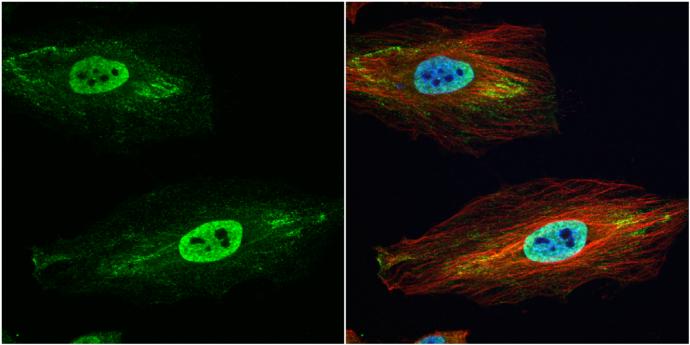 Glutathione S-Transferase pi 1/GSTP1 Antibody - BSA Free