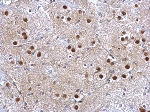 Glutathione S-Transferase pi 1/GSTP1 Antibody - BSA Free