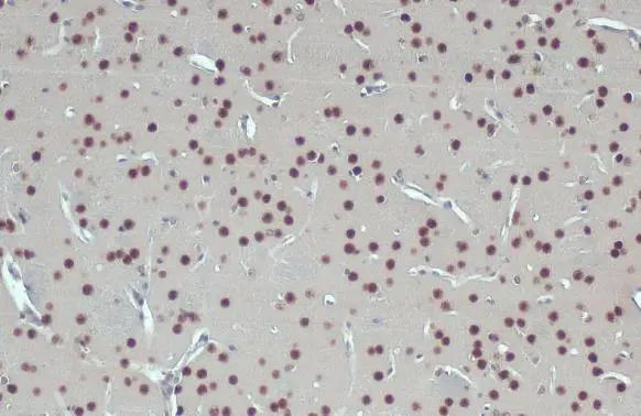 Glutathione S-Transferase pi 1/GSTP1 Antibody - BSA Free