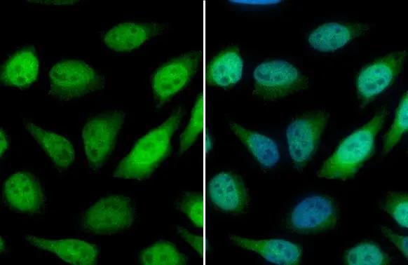 Glutathione S-Transferase pi 1/GSTP1 Antibody - BSA Free