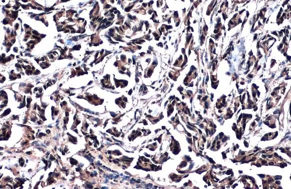 Glutathione S-Transferase pi 1/GSTP1 Antibody - BSA Free