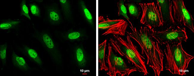 GTF2H1 Antibody