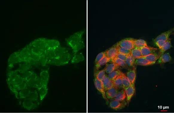 HADH Antibody - BSA Free