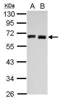 Hyaluronan Synthase 3/HAS3 Antibody - BSA Free