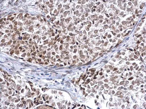 Histone Deacetylase 2/HDAC2 Antibody - BSA Free