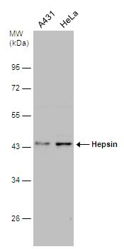 Hepsin Antibody - BSA Free