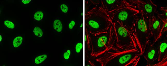 HIST1H3A Antibody