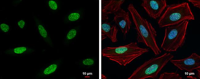 HIST1H3A Antibody