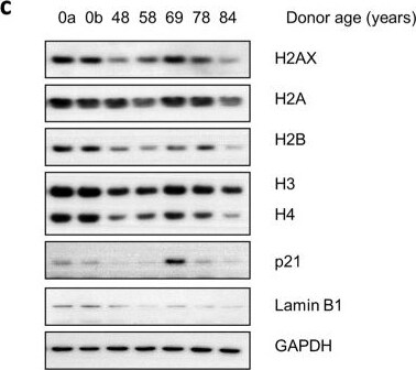 Histone H4 [ac Lys12, ac Lys16, ac Lys8, ac Lys5] Antibody
