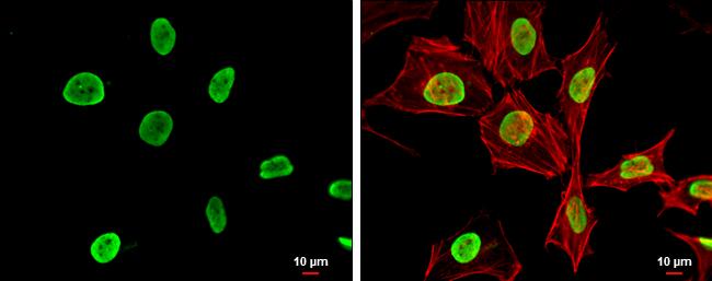 Histone H4 [ac Lys12, ac Lys16, ac Lys8, ac Lys5] Antibody