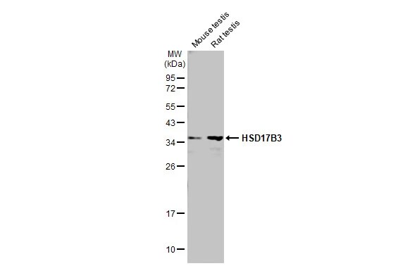 HSD17B3 Antibody