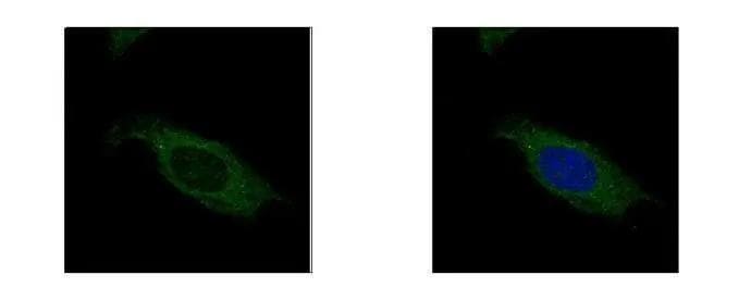 HSD17B3 Antibody