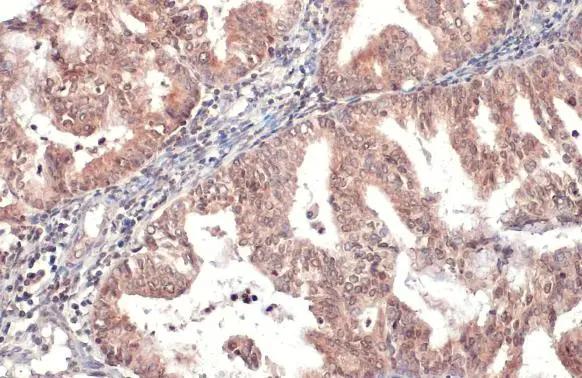 Hyaluronidase 1/HYAL1 Antibody - BSA Free