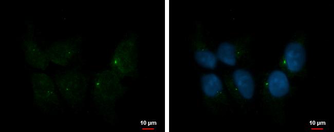 Ift80 Antibody - BSA Free