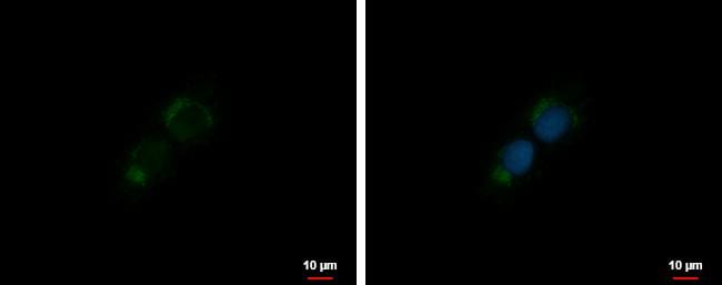 IGF-I/IGF-1 Antibody - BSA Free