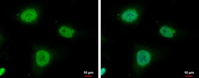 IGF2BP3 Antibody - BSA Free