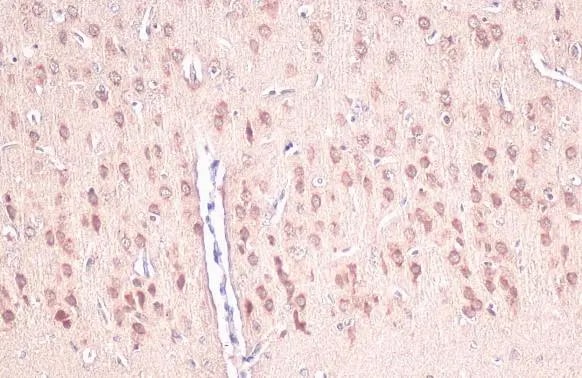 IGFBP-3 Antibody