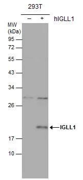 Lambda5/IGLL1 Antibody