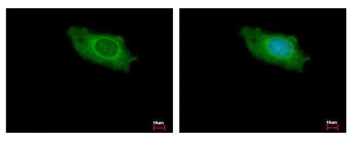 IKBKAP Antibody
