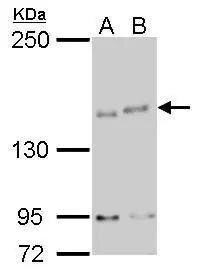 IKBKAP Antibody