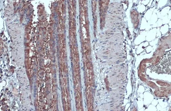IL-13R alpha 1 Antibody