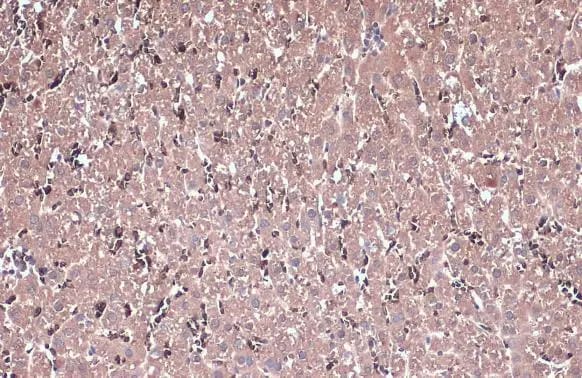 IL-13R alpha 1 Antibody