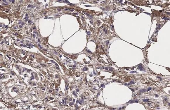 IL-13R alpha 1 Antibody