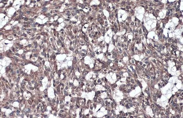 IL-1 RAcP/IL-1 R3 Antibody