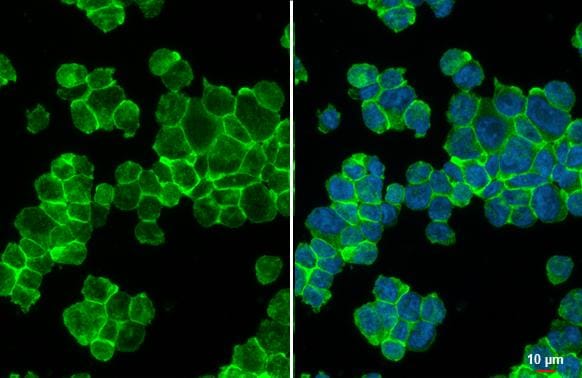 Common beta Chain Antibody - BSA Free