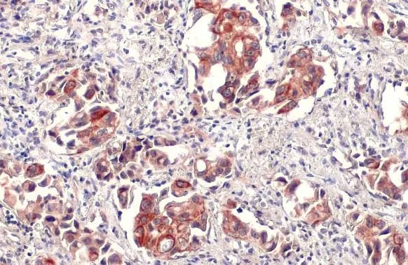 IL-6 Antibody
