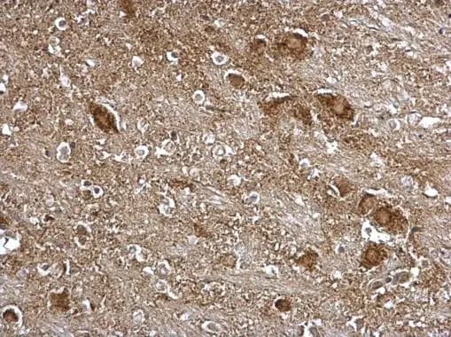 ITM2B Antibody