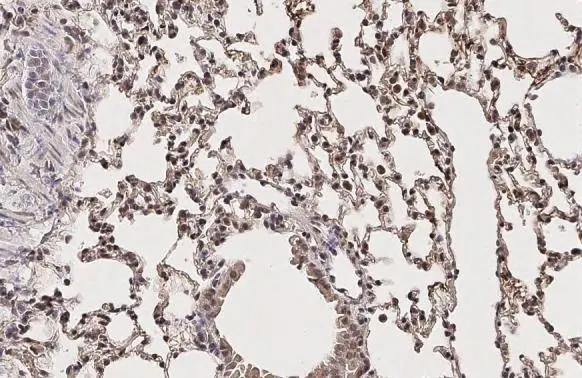 KAT2A/GCN5 Antibody