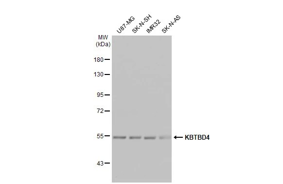 KBTBD4 Antibody