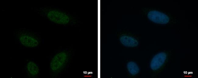 KCTD15 Antibody - BSA Free