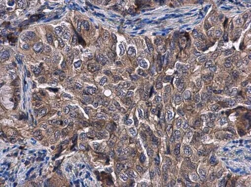 Kelch-Like 3 Antibody