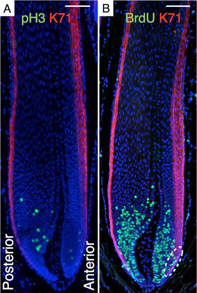 Cytokeratin 71 Antibody