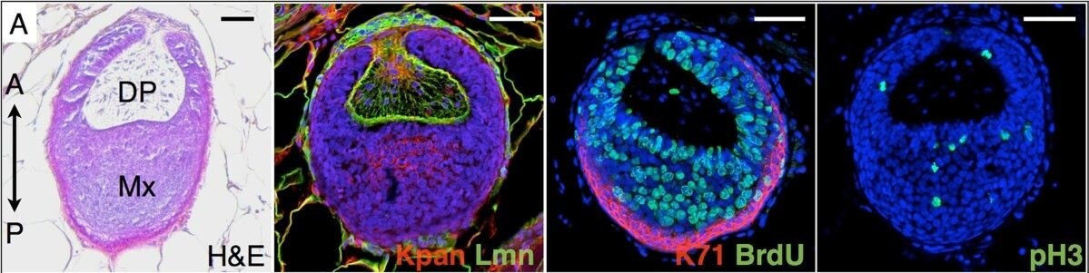 Cytokeratin 71 Antibody