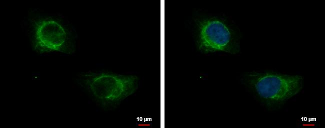 Cytokeratin 71 Antibody - BSA Free