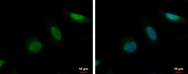 KIF2C Antibody